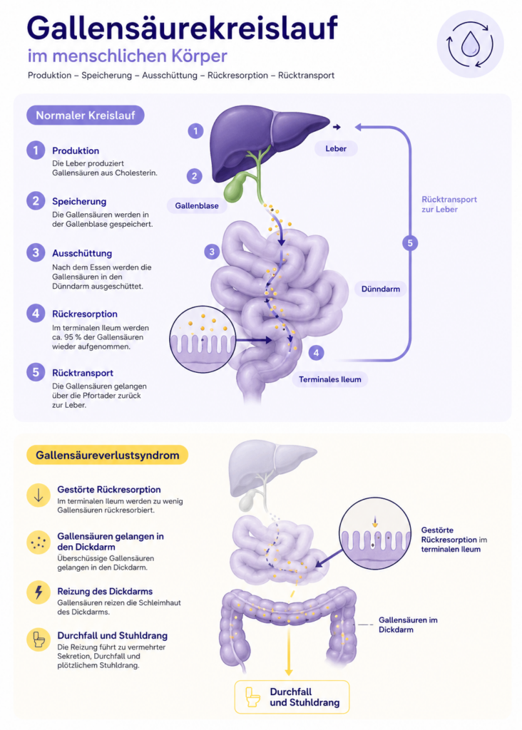 Infografik zum Gallensäurekreislauf im menschlichen Körper mit Produktion in der Leber, Speicherung in der Gallenblase, Rückresorption im terminalen Ileum und gestörter Rückresorption beim Gallensäureverlustsyndrom.